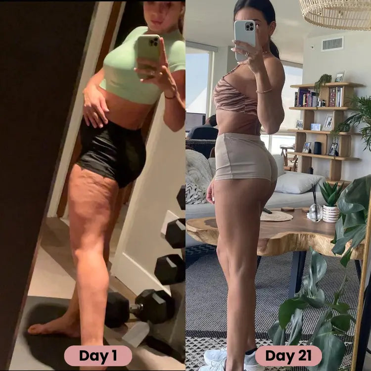 Nouvea™ -  Cellulite Massager Boutique Nouvea