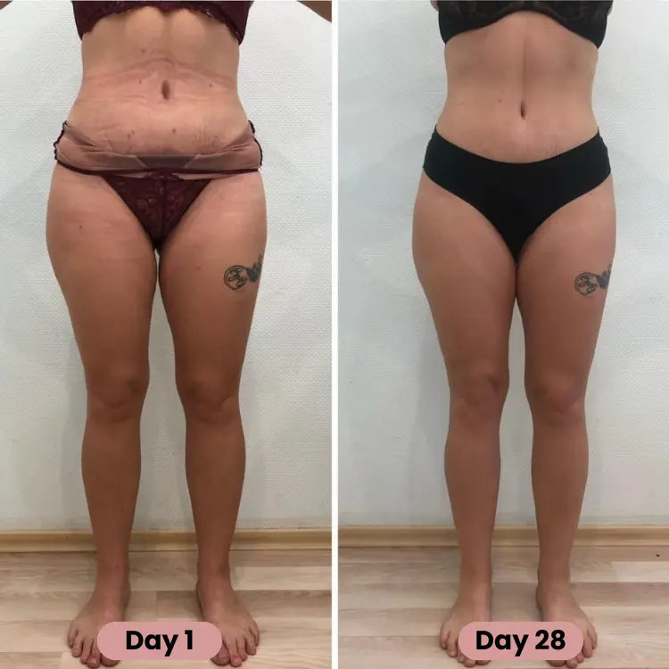 Nouvea™ -  Cellulite Massager Boutique Nouvea